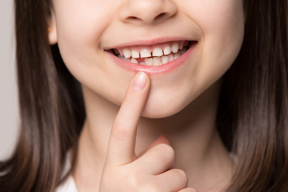 Proč nevyhazovat mléčné zuby vašich dětí? Jednou jim mohou zachránit život